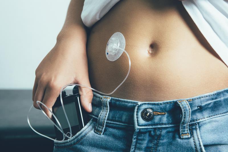 Next-gen automated insulin pump trumps current tech for glycaemic control in T1D