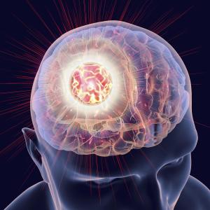 Add-on atezolizumab of no benefit in HER2-positive breast cancer with brain metastases