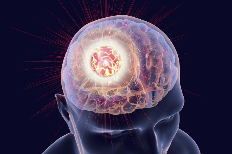 Add-on atezolizumab of no benefit in HER2-positive breast cancer with brain metastases