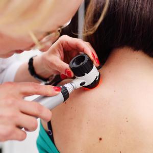 Second primary melanoma tied to better survival than single primary lesion