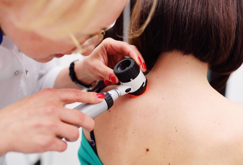 Second primary melanoma tied to better survival than single primary lesions