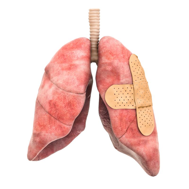 Nivolumab-ipilimumab displays potential in malignant pleural mesothelioma