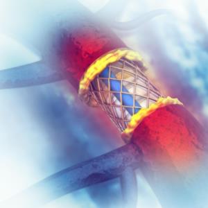 PCI inferior to CABG for CAD