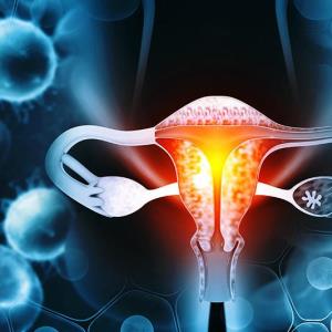 Niraparib maintenance yields favourable OS trend in patients with ovarian cancer