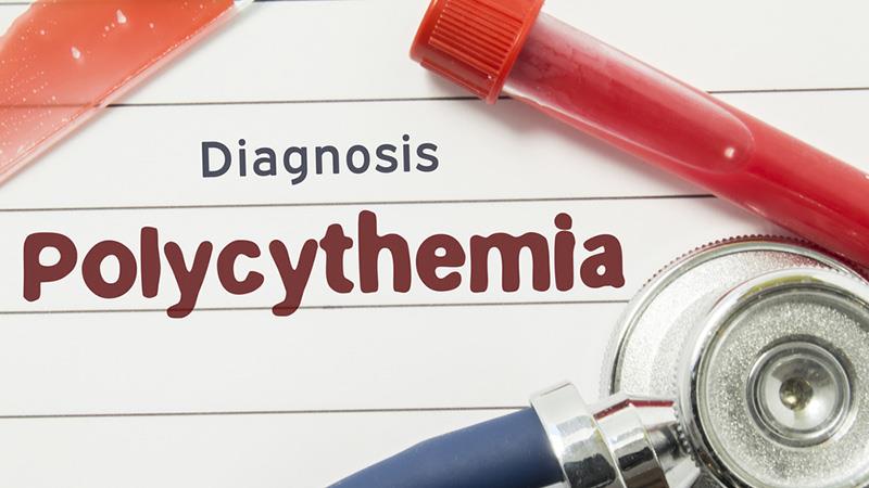 Should We Treat Earlier for Polycythaemia Vera (PV)?