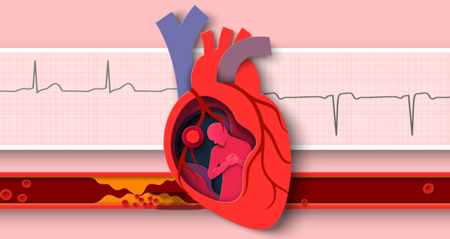 Cardiovascular Risk Reduction Clinic (CRRC) for enhanced management of atherosclerotic cardiovascular
disease,