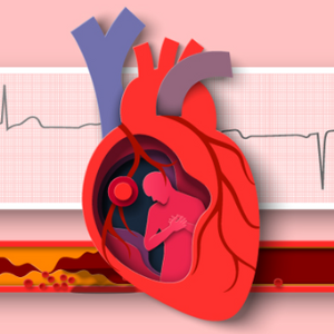 Cardiovascular Risk Reduction Clinic (CRRC) for enhanced management of atherosclerotic cardiovascular
disease,