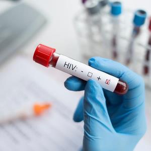 Simple tests predict liver stiffness in people living with HIV, liver disease