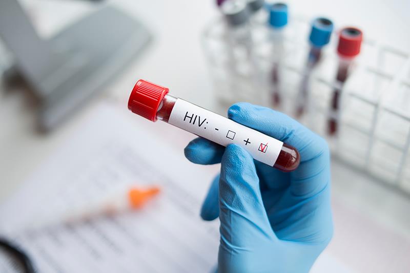 Simple tests predict increased liver stiffness in people living with HIV, liver disease