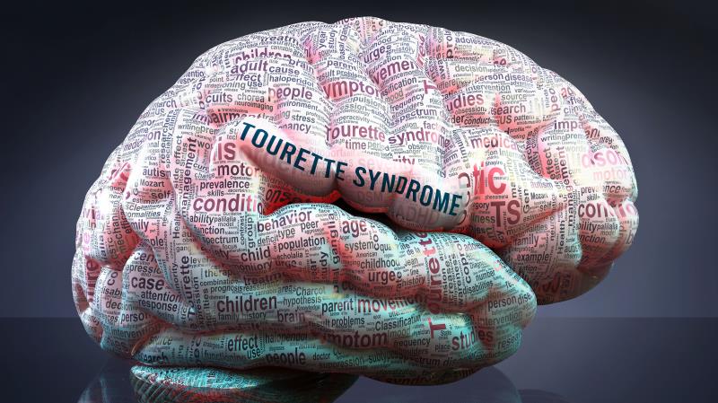 Novel drug promising for paediatric Tourette syndrome