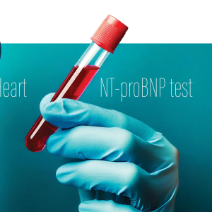 NT-proBNP predicts cardiorenal complications in Chinese patients with T2D