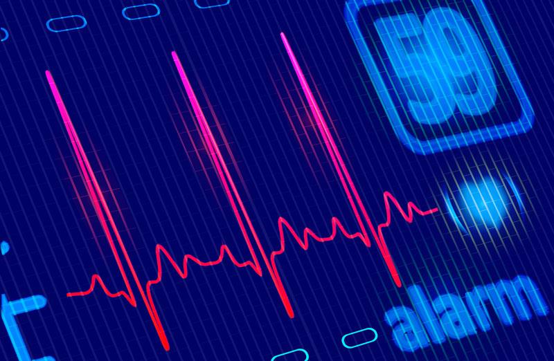 Preoperative NT-proBNP strongly predicts cardiovascular events after noncardiac surgery