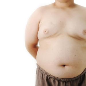 High serum bilirubin lowers obesity risk in kids