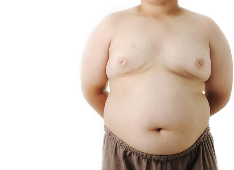 High serum bilirubin lowers obesity risk in kids