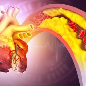 Obicetrapib cuts LDL-C in patients with HeFH