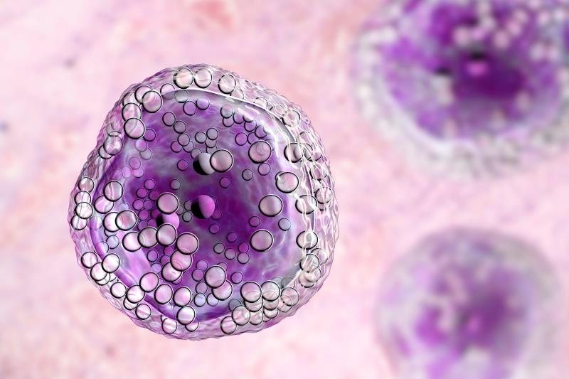 Bulky tumours in PCNSL tied to high local treatment failure