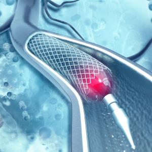 Shorter outshines longer DAPT for ACS patients following DES implantation