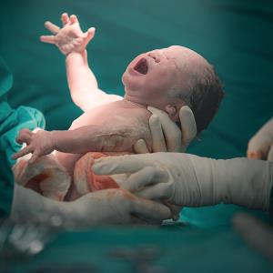 Caesarean delivery seems to increase blood pressure in young adulthood