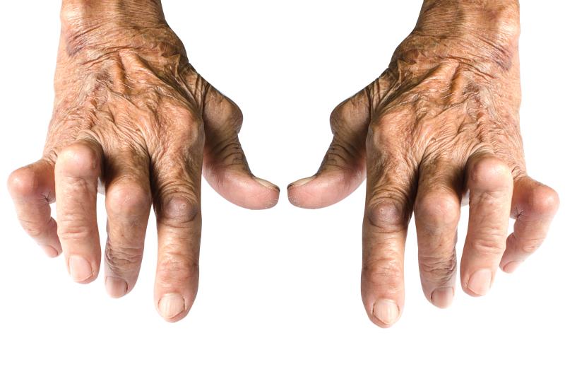 Olokizumab superior to placebo, noninferior to adalimumab for rheumatoid arthritis