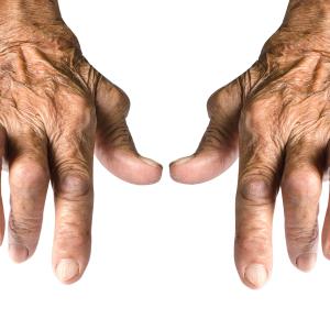 Olokizumab superior to placebo, noninferior to adalimumab for rheumatoid arthritis