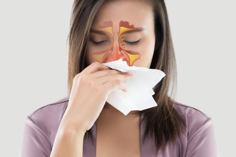 Omalizumab shows sustained benefits in chronic rhinosinusitis with polyps