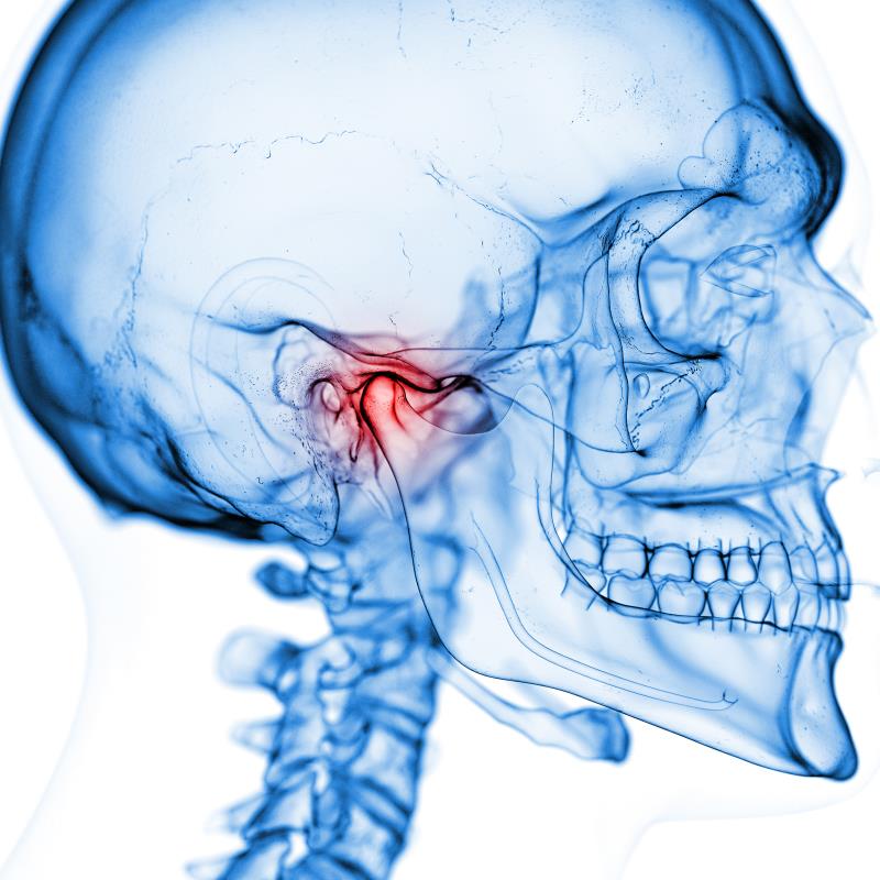 Low-dose onabotulinumtoxinA used for TMJ disorders does not affect jaw morphology