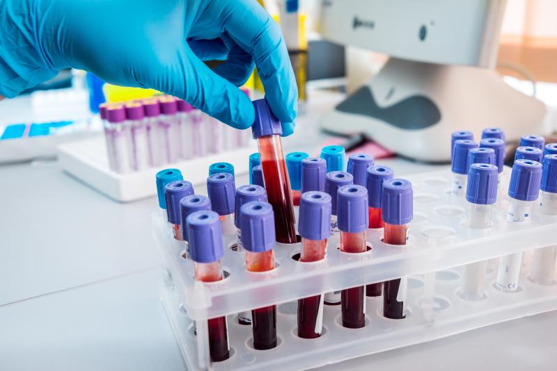 Circulating IL-17A predicts CVD in early RA