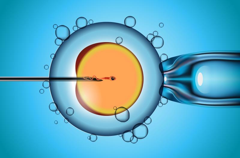 Oocyte microinjection device allows more efficient intracytoplasmic sperm injection