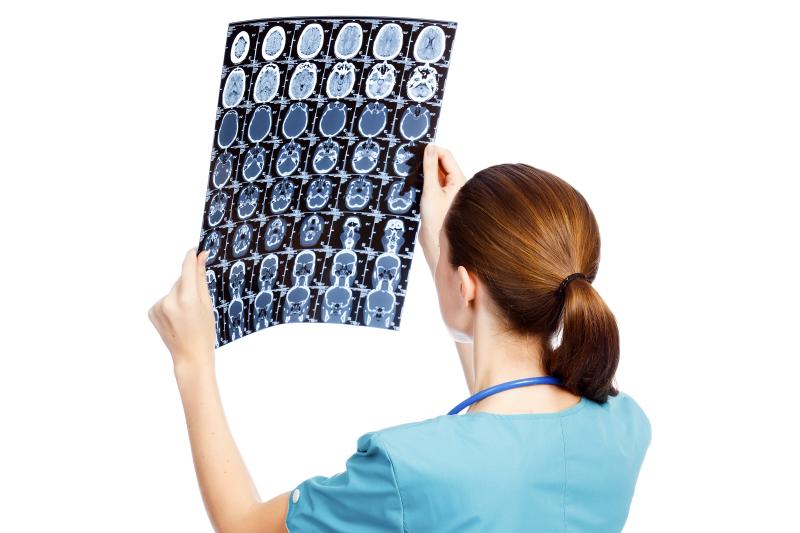 Anti-CD20 monoclonal antibodies show promise in multiple sclerosis after failed alemtuzumab