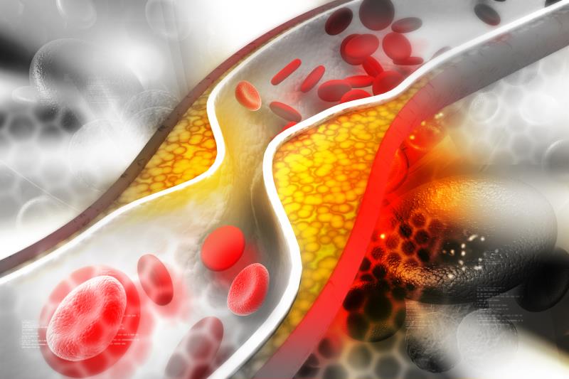 Pooled ORION analysis boosts lipid-lowering potential of inclisiran