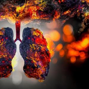 Osimertinib kéo dài PFS thêm 3,2 năm trong nghiên cứu LAURA