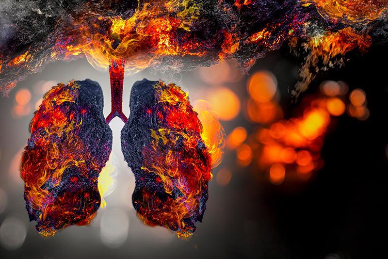 Osimertinib kéo dài PFS thêm 3,2 năm trong nghiên cứu LAURA