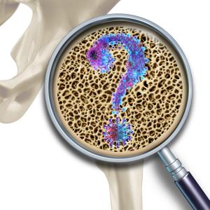 Osteoporosis management slumps as COVID-19 pandemic rises