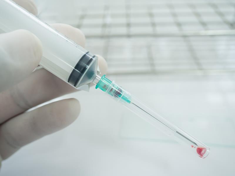 Pancreatitis rare after EUS-guided fine-needle aspiration