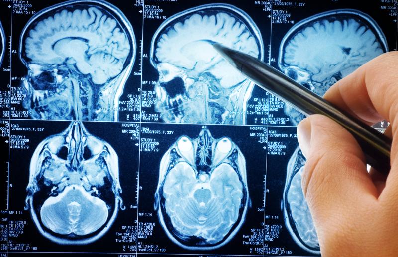 Mood, physical function tied to HRQoL in patients with brain metastases