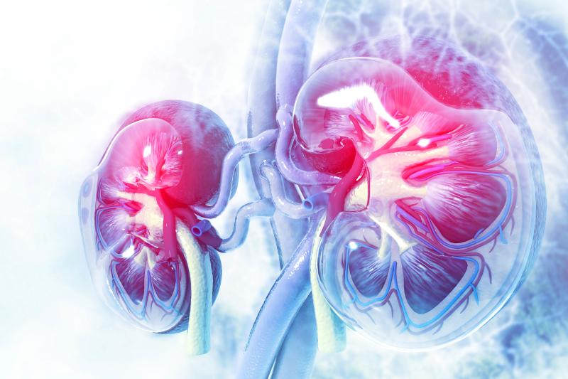 Characterizing elevated urinary ammonium in nephrolithiasis