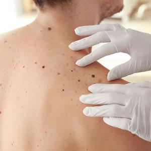 Pembrolizumab extends survival in advanced melanoma