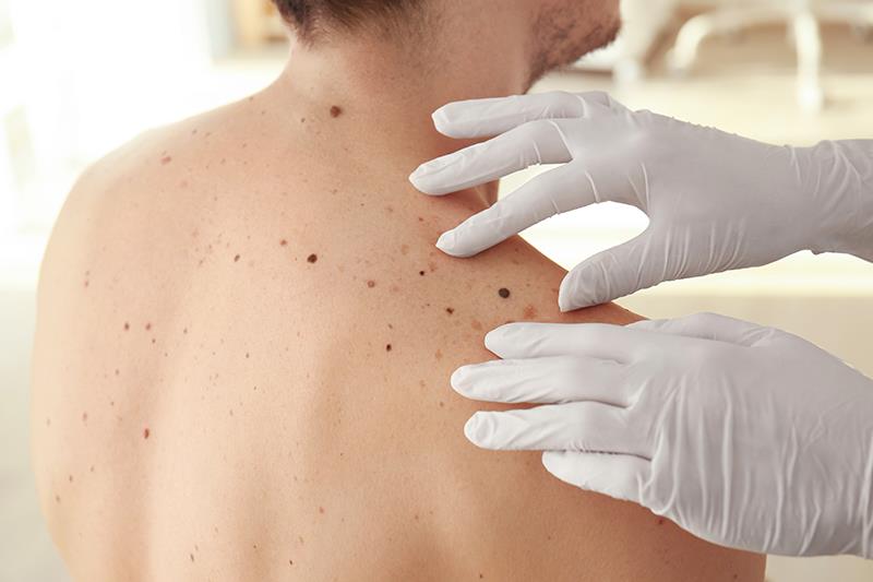 Pembrolizumab extends survival in advanced melanoma