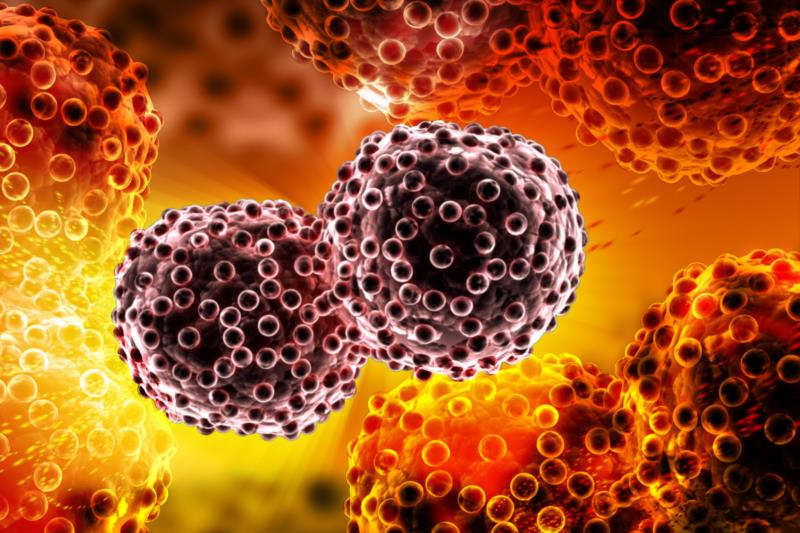 Local failure common in metastases from right-sided primary CRC treated with SABR