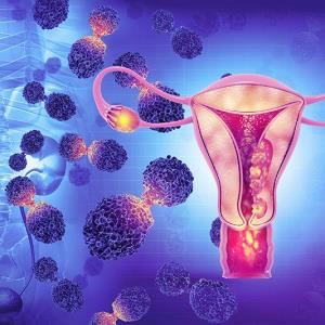 Pembrolizumab plus chemo ups survival in advanced endometrial cancer across MMR subgroups