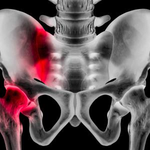 Hip fracture may lead to immediate death in older adults with CHD