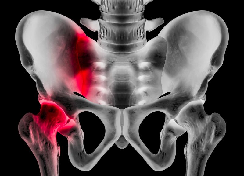 Hip fracture may lead to immediate death in older adults with CHD