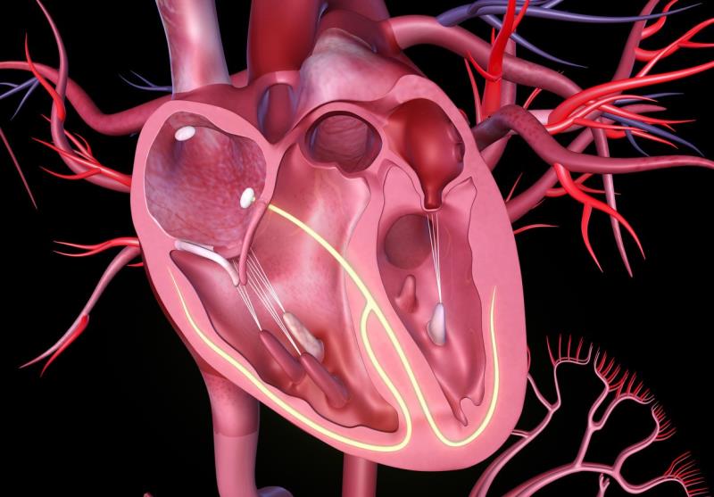 BPA effective for residual pulmonary hypertension, but carries higher burden of complications