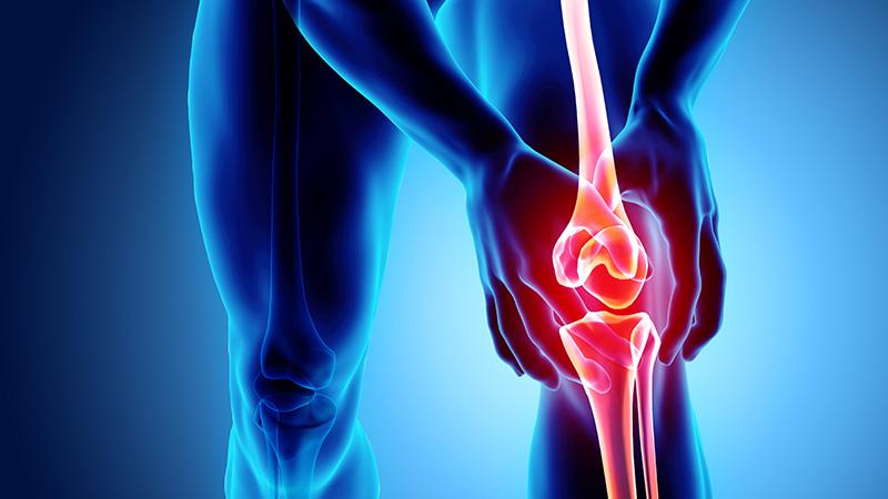 Knee osteoarthritis management
with ESCEO guidelines:
The importance of a multimodal approach