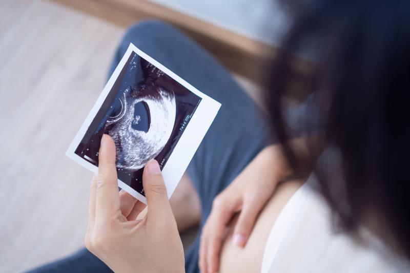 Plasma kisspeptin portends risk of pregnancy loss