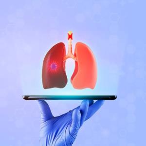 Pre-emptive lung cancer detection may be possible with novel device
