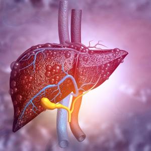 Noninvasive scores use LSM to detect cirrhosis, advance fibrosis in NAFLD