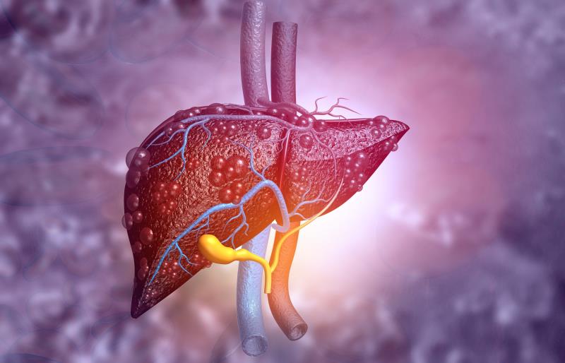 Noninvasive scores use LSM to detect cirrhosis, advance fibrosis in NAFLD