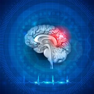 Prior stroke may influence ischaemic stroke risk in cancer patients