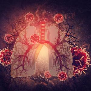 Risk for thrombotic events higher after respiratory infections needing hospitalization